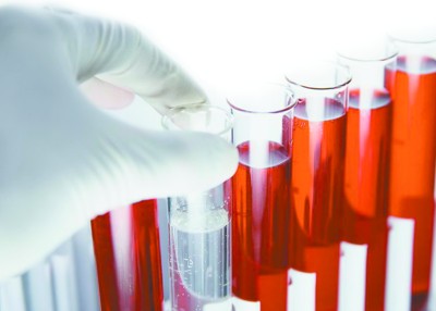 血检如何捕捉肿瘤的踪迹？